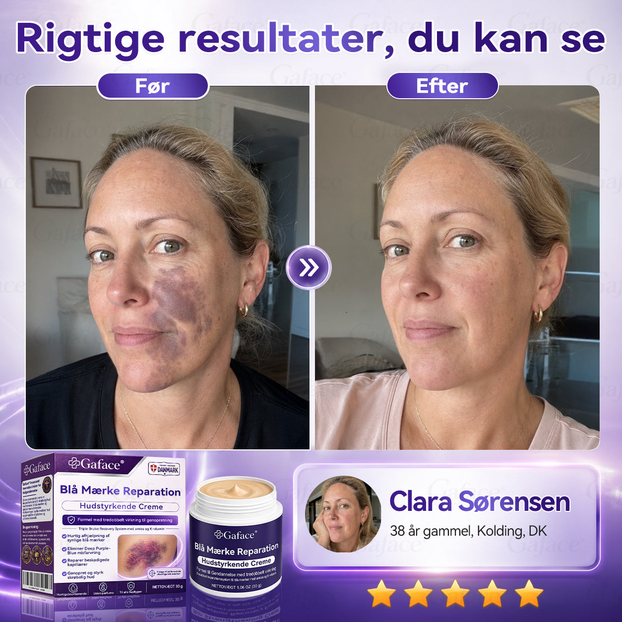 🌼💖𝐎𝐟𝐟𝐢𝐜𝐢𝐞𝐥 𝐝𝐚𝐧𝐬𝐤 𝐛𝐮𝐭𝐢𝐤  | 𝐆𝐚𝐟𝐚𝐜𝐞® 𝐁𝐄𝐑𝐁𝐄𝐑𝐈𝐍𝐄 𝐗 𝐍𝐀𝐃+𝟏𝟎-𝐈-𝟏 𝐀𝐕𝐀𝐍𝐂𝐄𝐑𝐄𝐓 𝐅𝐎𝐑𝐌𝐄𝐋 𝐀𝐯𝐚𝐧𝐜𝐞𝐫𝐞𝐭 𝐍𝐚𝐧𝐨-𝐌𝐢𝐤𝐫𝐨𝐧å𝐥 𝐏𝐥𝐚𝐬𝐭𝐞𝐫.