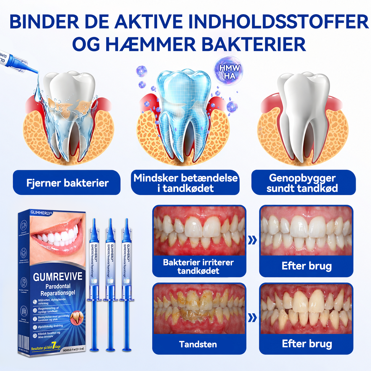 🍑🎟️𝑮𝒍𝒊𝒎𝒎𝒆𝒓𝒍𝒚®🦷𝑮𝒖𝒎𝑹𝒆𝒗𝒊𝒗𝒆 𝑷𝒂𝒓𝒐𝒅𝒐𝒏𝒕𝒂𝒍 𝑹𝒆𝒑𝒂𝒓𝒂𝒕𝒊𝒐𝒏𝒔𝒈𝒆𝒍