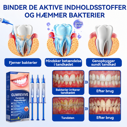 🍑🎟️𝑮𝒍𝒊𝒎𝒎𝒆𝒓𝒍𝒚®🦷𝑮𝒖𝒎𝑹𝒆𝒗𝒊𝒗𝒆 𝑷𝒂𝒓𝒐𝒅𝒐𝒏𝒕𝒂𝒍 𝑹𝒆𝒑𝒂𝒓𝒂𝒕𝒊𝒐𝒏𝒔𝒈𝒆𝒍