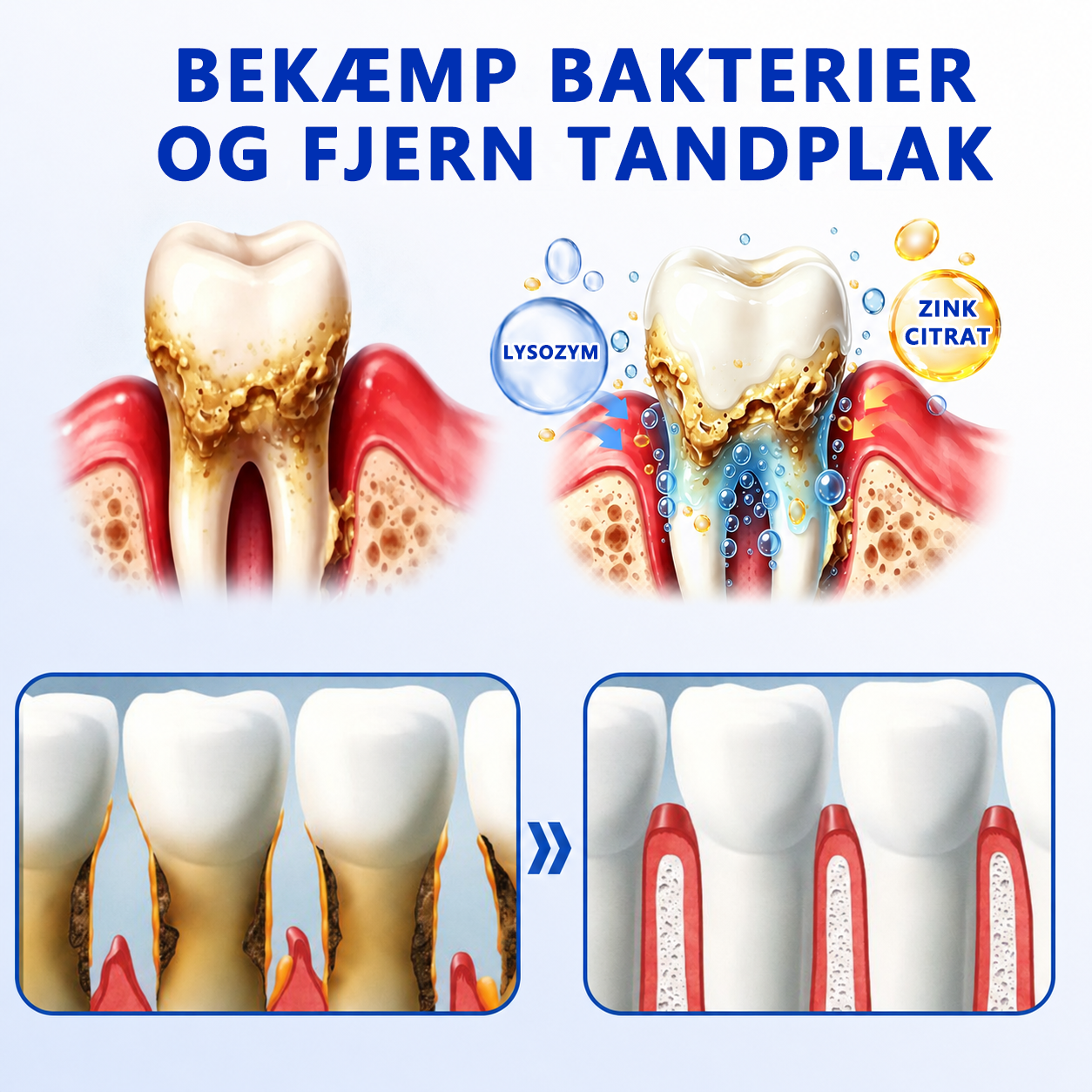 🍑🎟️𝑮𝒍𝒊𝒎𝒎𝒆𝒓𝒍𝒚®🦷𝑮𝒖𝒎𝑹𝒆𝒗𝒊𝒗𝒆 𝑷𝒂𝒓𝒐𝒅𝒐𝒏𝒕𝒂𝒍 𝑹𝒆𝒑𝒂𝒓𝒂𝒕𝒊𝒐𝒏𝒔𝒈𝒆𝒍