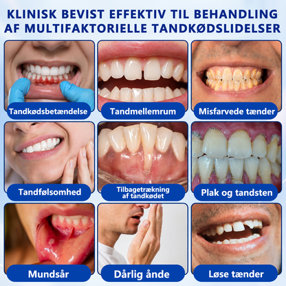 🍑🎟️𝑮𝒍𝒊𝒎𝒎𝒆𝒓𝒍𝒚®🦷𝑮𝒖𝒎𝑹𝒆𝒗𝒊𝒗𝒆 𝑷𝒂𝒓𝒐𝒅𝒐𝒏𝒕𝒂𝒍 𝑹𝒆𝒑𝒂𝒓𝒂𝒕𝒊𝒐𝒏𝒔𝒈𝒆𝒍
